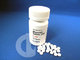 �~�m�L�V�W�� 10mg �@2.5mg�iMinoxidil �j